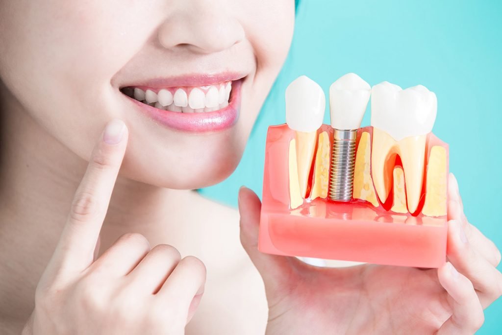 implant
